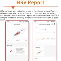 696 F400 Smart Watch 1.55 inch Smart Band Fitness Bracelet Bluetooth ECG+PPG Pedometer Call Reminder Compatible with Android iOS Men Hands-Free Calls Message Reminder IP 67 46mm Watch Case
