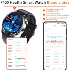 696 F400 Smart Watch 1.55 inch Smart Band Fitness Bracelet Bluetooth ECG+PPG Pedometer Call Reminder Compatible with Android iOS Men Hands-Free Calls Message Reminder IP 67 46mm Watch Case