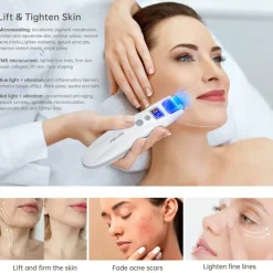 2023 Newest 540pins EMS Derma Roller Micro Current Microneedling Roller with Red Blue Light Therapy and Vibration Bio Roller G5