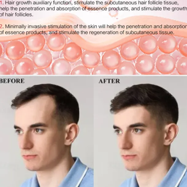 2023 Newest 540pins EMS Derma Roller Micro Current Microneedling Roller with Red Blue Light Therapy and Vibration Bio Roller G5