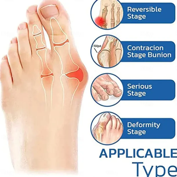 5 Pairs Orthopedic Toe Compression Sock Women's Toe Socks Projoint Antibunions Health Sock - Sock Align Toe Socks for Bunion - Anti Bunion Socks for Women and Men