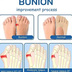 5 Pairs Orthopedic Toe Compression Sock Women's Toe Socks Projoint Antibunions Health Sock - Sock Align Toe Socks for Bunion - Anti Bunion Socks for Women and Men