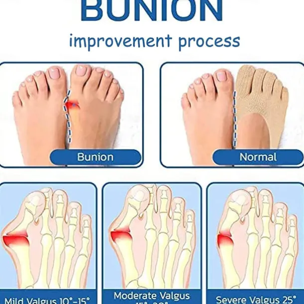 5 Pairs Orthopedic Toe Compression Sock Women's Toe Socks Projoint Antibunions Health Sock - Sock Align Toe Socks for Bunion - Anti Bunion Socks for Women and Men