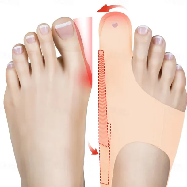 Bunion Corrector For Relieving Thumb Valgus Bunion Socks That Can Be Worn Day And Night Beautiful And Practical Bunion Correctors Toe Straightener For Women And Men