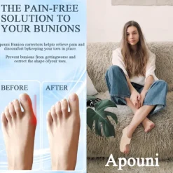 Bunion Corrector For Relieving Thumb Valgus Bunion Socks That Can Be Worn Day And Night Beautiful And Practical Bunion Correctors Toe Straightener For Women And Men