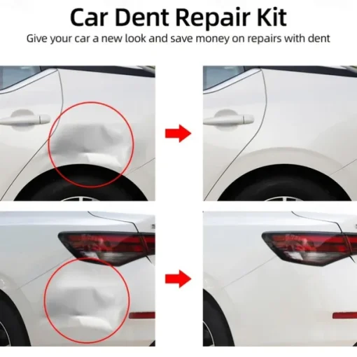 Car Dent Puller Suction Cups Auto Body Dent Removal Tools Strong Suction Cup Car Repair Kit Car Accessories