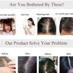 Choices 120% Density Silk Base Top Hairpiece 100% Human Hair Extensions Clip In On Hair Topper For Women Hand-made Top Hair Piece Middle Part With Thinning Hair Loss Hair #4 Medium Brown 6'' 27g