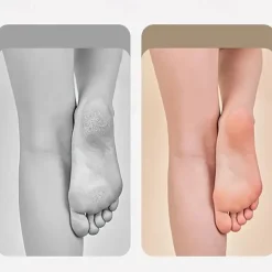 Electric Callus Remover For Feet With Dander Vacuum Cleaner Rechargeable Foot Callus Remover Pedicure Tools Foot File Professional Foot Care Kit Dead Skin Remover With 3 Heads & 2 Speed LCD Display