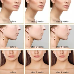 EMS Facial Lifting Device LED Photon Therapy Face Slimming Vibration Massager Double Chin V Line Lift Belt Cellulite Jaw Device