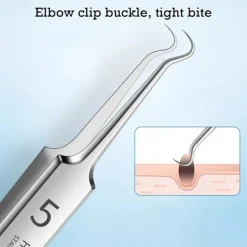 German Ultra-Fine Pimple Tweezers for Acne and Blackhead Removal - Salon Quality Beauty Tool for Face Health and Care