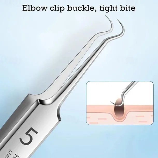 German Ultra-Fine Pimple Tweezers for Acne and Blackhead Removal - Salon Quality Beauty Tool for Face Health and Care