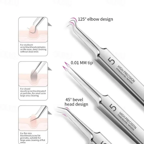 German Ultra-Fine Pimple Tweezers for Acne and Blackhead Removal - Salon Quality Beauty Tool for Face Health and Care