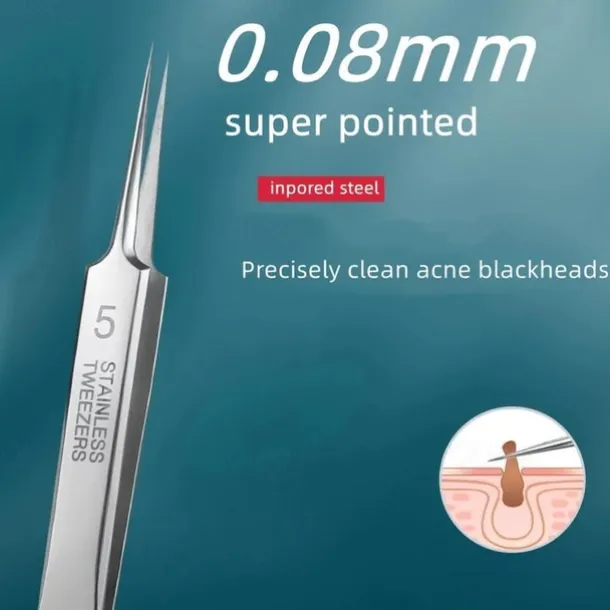 German Ultra-Fine Pimple Tweezers for Acne and Blackhead Removal - Salon Quality Beauty Tool for Face Health and Care