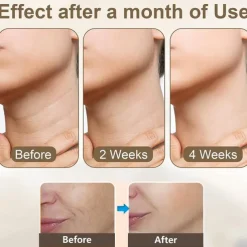 HY48 Neck Anti Wrinkle Face Lifting Beauty Device Led Photon Therapy Skin Tighten Reduce Double Chin Remove Neck Lines