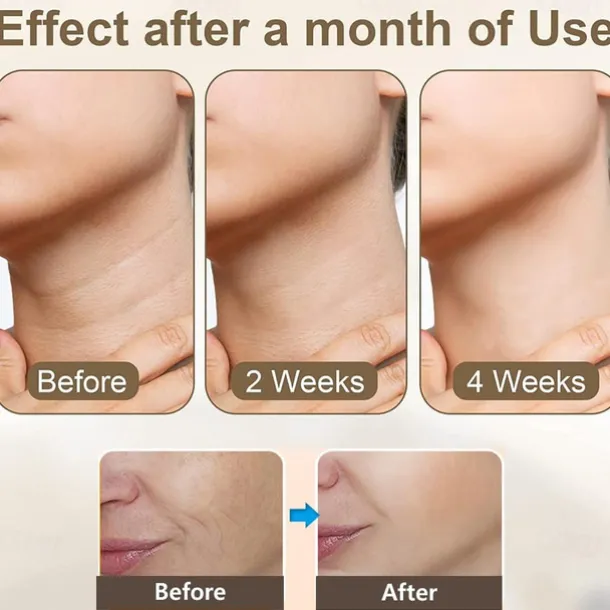 HY48 Neck Anti Wrinkle Face Lifting Beauty Device Led Photon Therapy Skin Tighten Reduce Double Chin Remove Neck Lines