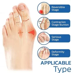 Orthoes Bunion Relief Socks Women - Orthopedic Toe Compression Sock - Projoint Antibunions Health Sock - Sock Align Toe Socks for Bunion - Anti Bunion Socks for Women and Men