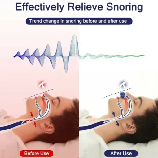 1pc Anti Snoring Devices Nose Air Purifier Snoring Solution Snore Reducing Nose Vents Plugs Anti Snoring Device For Easing Breathing And Comfortable Sleep For Men And Women