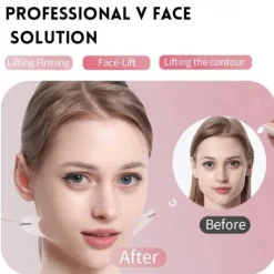 40PCS Face Lift Tapes Sticker With 8 Fixed Rope, Instant V-shape Face Lift Bands, Face Lifting Tapes Double Chin Reducer Face Wrinkle Patches