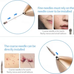 Plasma Pen Laser Tattoo Mole Removal Machine LCD Rechargeable Face Care Skin Tag Removal Freckle Wart Dark Spot Remover