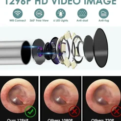Rechargeable Ear Wax Removal Endoscope Kit with 5 Scoops, 8 Picks, and 1080P Camera, 1296P FHD Wireless Ear Otoscope with 6 LED 3.6mm Visual Ear Scope Camera