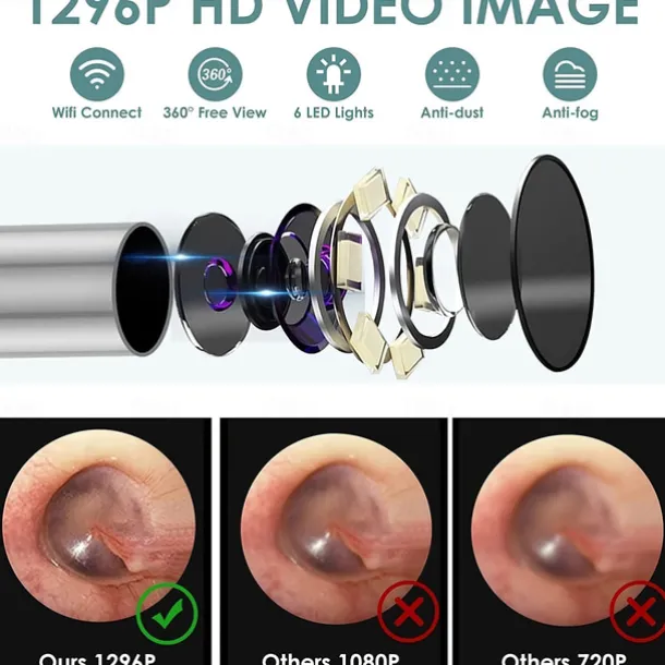 Rechargeable Ear Wax Removal Endoscope Kit with 5 Scoops, 8 Picks, and 1080P Camera, 1296P FHD Wireless Ear Otoscope with 6 LED 3.6mm Visual Ear Scope Camera