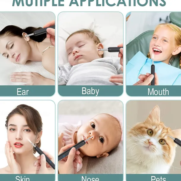 Rechargeable Ear Wax Removal Endoscope Kit with 5 Scoops, 8 Picks, and 1080P Camera, 1296P FHD Wireless Ear Otoscope with 6 LED 3.6mm Visual Ear Scope Camera