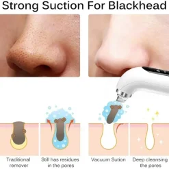 Small Bubble Blackhead Remover Vacumm With Led Light Water Cycle Black Head Cleaner Deep Cleaning Acne Pimple Removal