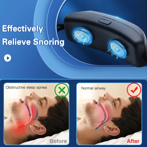 Smart Anti Snoring Device EMS Pulse Stop Snore Portable Comfortable Sleep Well Stop Snore Health Care Sleep Apnea Aid USB