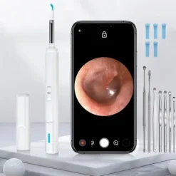 Smart Visual Ear Cleaner Ear Stick Endoscope Earpick Camera Otoscope Ear Cleaner Ear Wax Remover Ear Picker Earwax Removal Tool