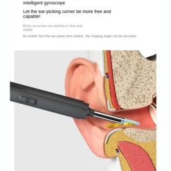 Smart Visual Ear Cleaner Ear Stick Endoscope Earpick Camera Otoscope Ear Cleaner Ear Wax Remover Ear Picker Earwax Removal Tool