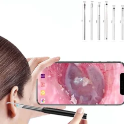 Smart Visual Ear Cleaner Ear Stick Endoscope Earpick Camera Otoscope Ear Cleaner Ear Wax Remover Ear Picker Earwax Removal Tool