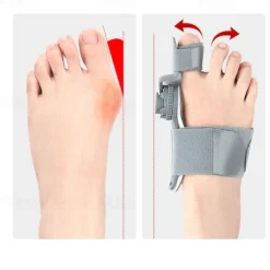 Thumb Deviation Corrector Big Toe Overlap Separator Night And Day Use Rotating Adjustable Corrector